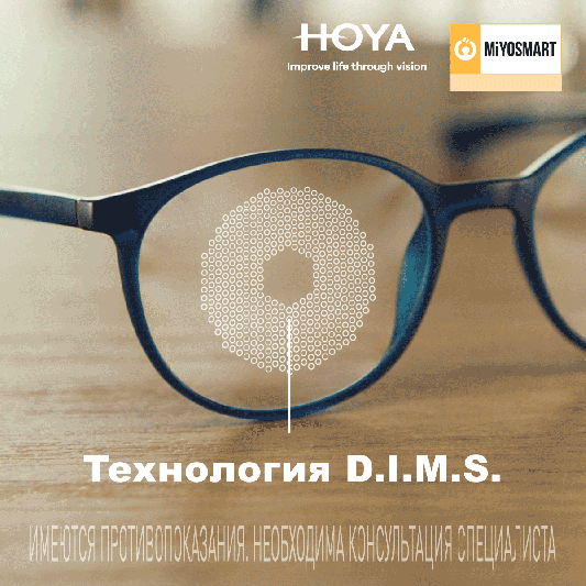 MiYOSMART и MiYOSMART iQ — линзы для контроля миопии теперь в «Оптик-Центре»