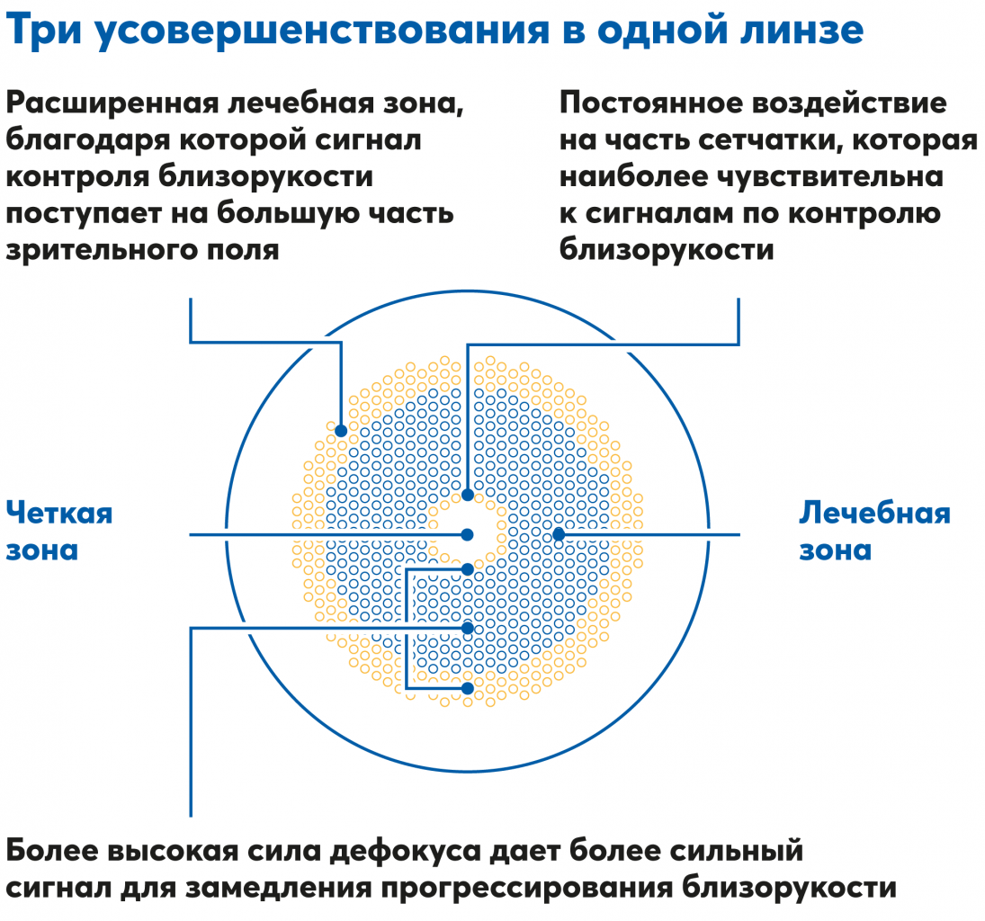 MiYOSMART iQ усовершенствованные линзы для контроля миопии у детей в наличии в салонах Оптик-Центр.png MiYOSMART iQ усовершенствованные линзы для контроля миопии у детей в наличии в салонах Оптик-Центр.png